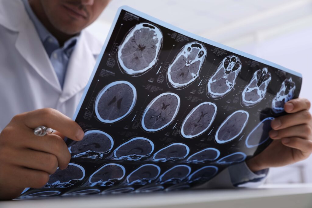 Cuando ocurre un accidente y se produce daño cerebral, ¿qué se debe hacer?