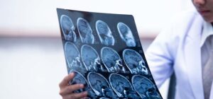 lesión cerebral en un accidente