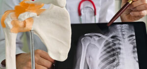 indemnización por operación de hombro