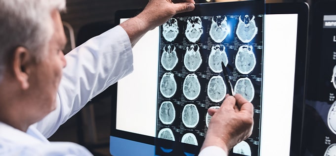 plazo para presentar una demanda por lesión cerebral traumática