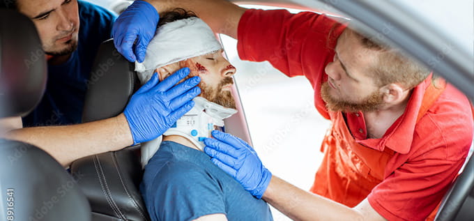 trauma después de un accidente